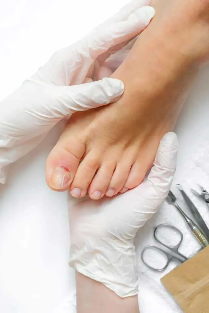 pedicure podologist patient on medical pedicure scaled 1