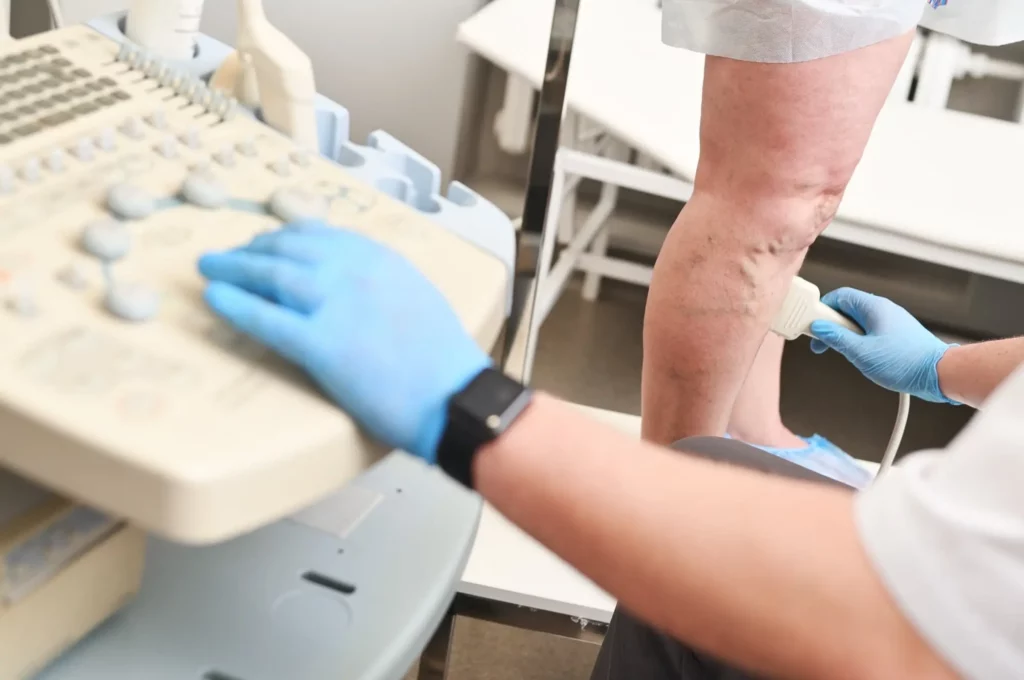 a phlebologist does an ultrasound of the veins of 2022 05 17 07 08 20 utc